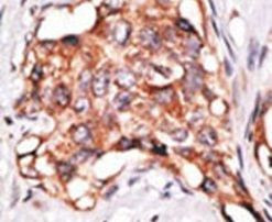 GDF3 Antibody in Immunohistochemistry (IHC)