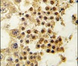 GDF3 Antibody in Immunohistochemistry (IHC)