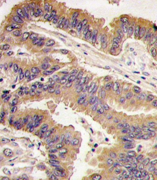 GDF5 Antibody in Immunohistochemistry (IHC)