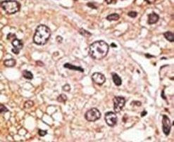 GDF9 Antibody in Immunohistochemistry (IHC)