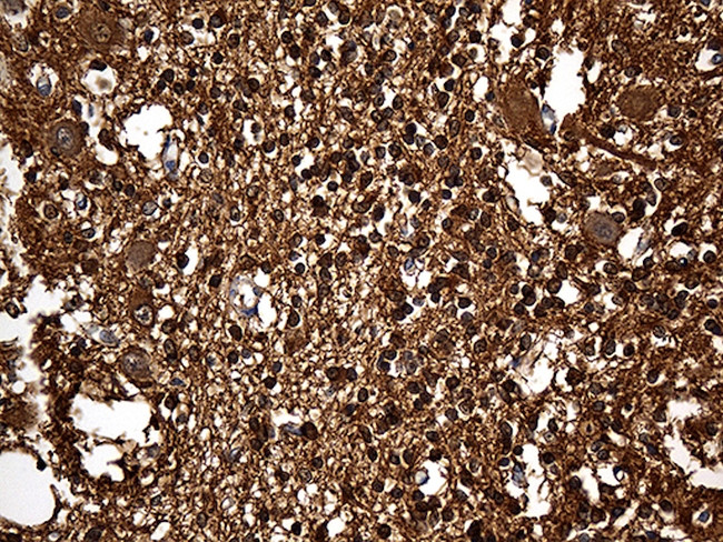 GDI1 Antibody in Immunohistochemistry (Paraffin) (IHC (P))