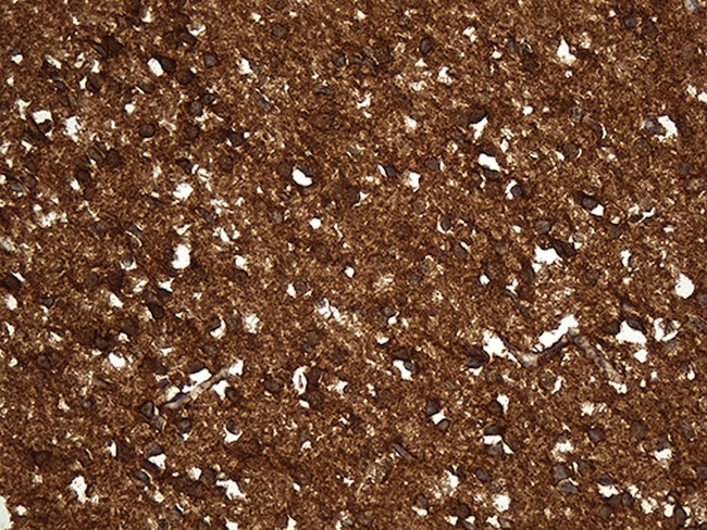 GDI1 Antibody in Immunohistochemistry (Paraffin) (IHC (P))