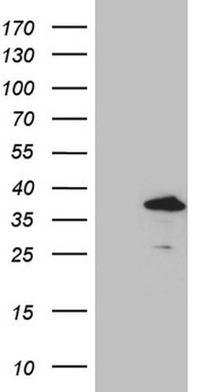 GEMIN2 Antibody in Western Blot (WB)