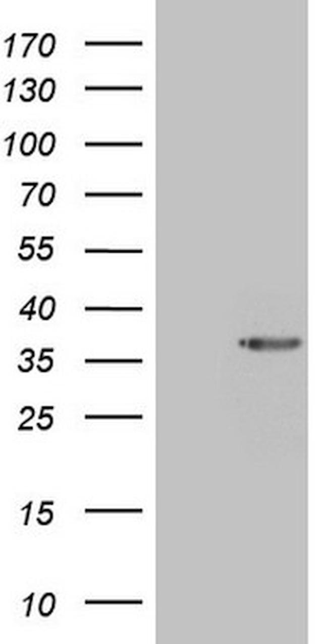 GEMIN2 Antibody in Western Blot (WB)