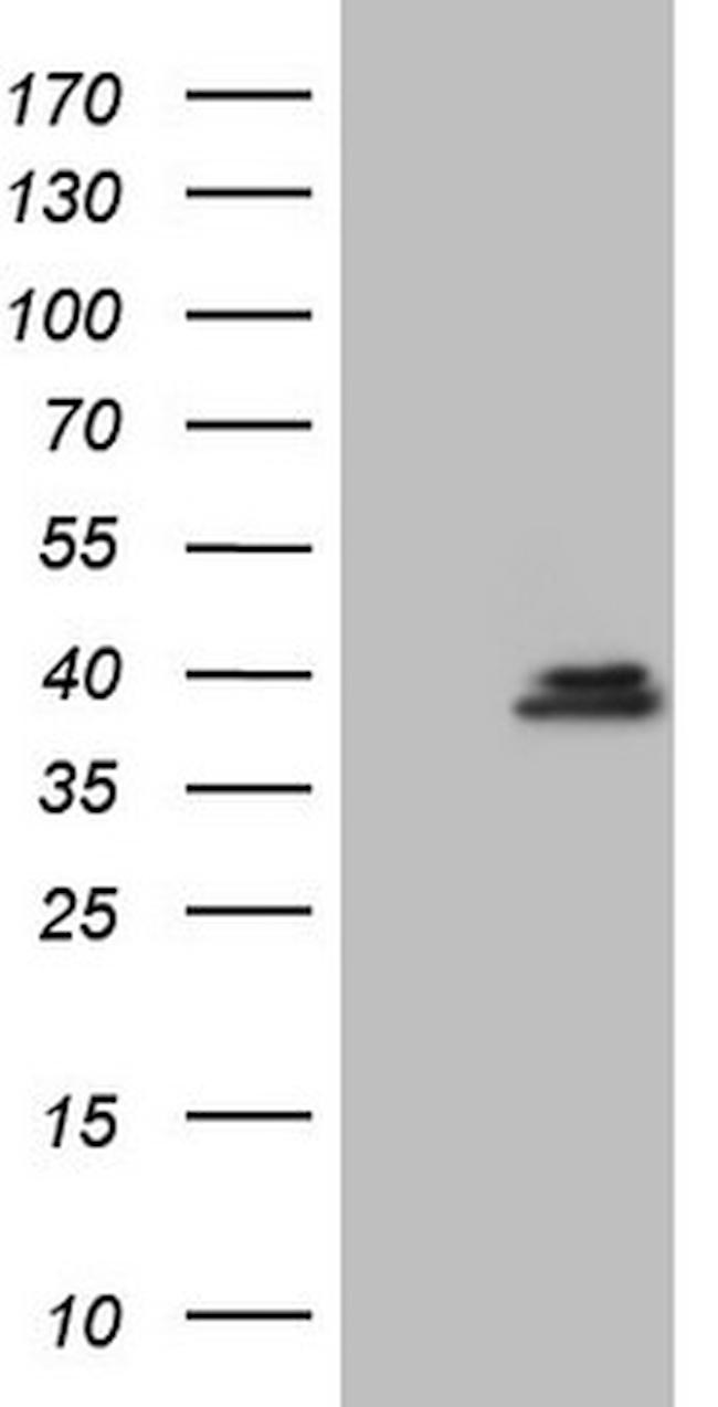 GEMIN8 Antibody in Western Blot (WB)