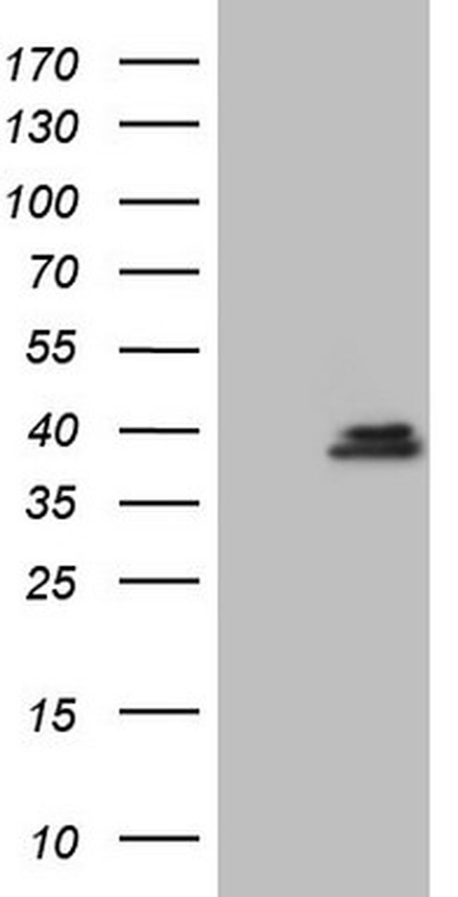 GEMIN8 Antibody in Western Blot (WB)