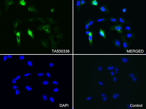 GFAP Antibody in Immunocytochemistry (ICC/IF)