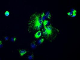 GFAP Antibody in Immunocytochemistry (ICC/IF)
