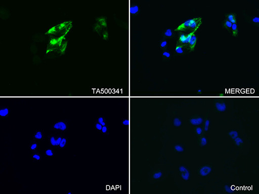 GFAP Antibody in Immunocytochemistry (ICC/IF)