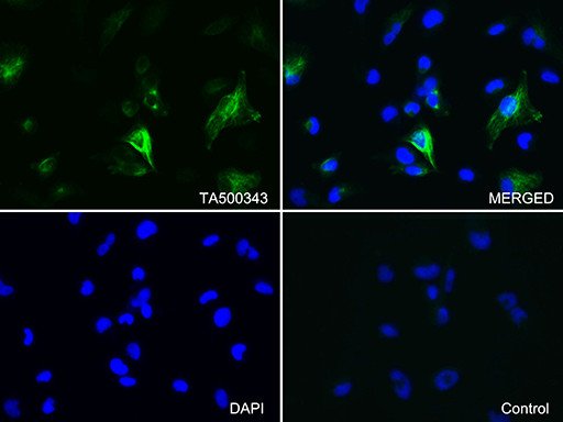 GFAP Antibody in Immunocytochemistry (ICC/IF)