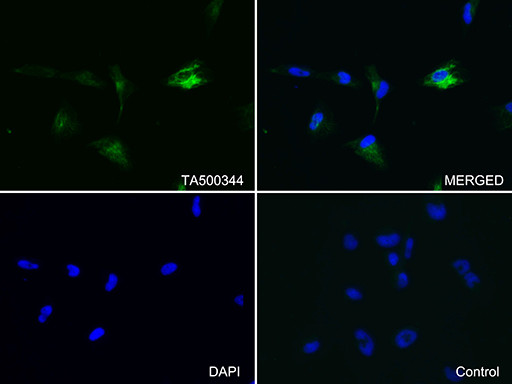 GFAP Antibody in Immunocytochemistry (ICC/IF)
