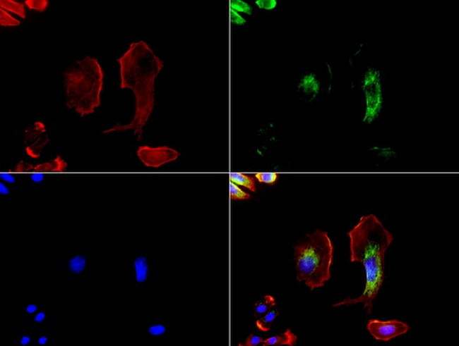 GFAP Antibody in Immunocytochemistry (ICC/IF)