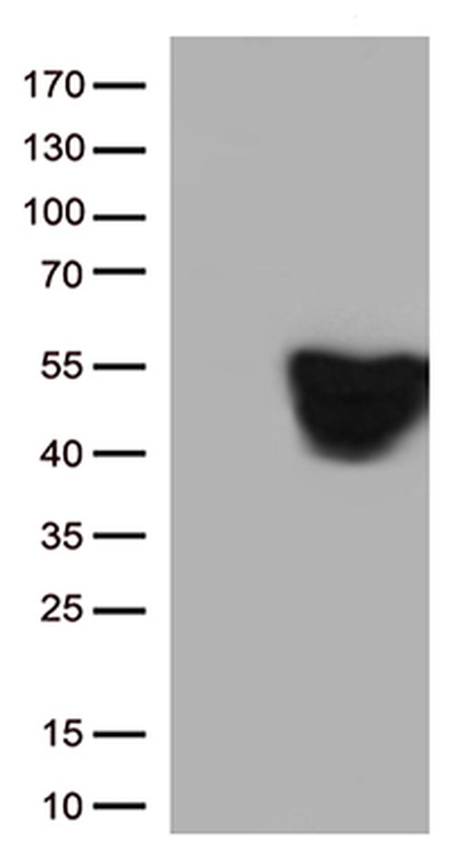 GFAP Antibody in Western Blot (WB)
