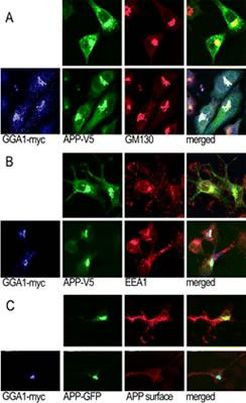 GGA1 Antibody in Immunocytochemistry (ICC/IF)