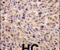 GGPS1 Antibody in Immunohistochemistry (IHC)