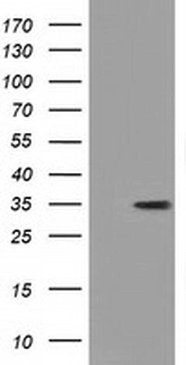 GGPS1 Antibody in Western Blot (WB)