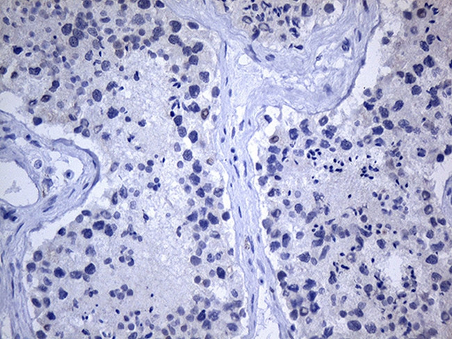 GH2 Antibody in Immunohistochemistry (Paraffin) (IHC (P))