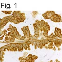 GHRHR Antibody in Immunohistochemistry (IHC)