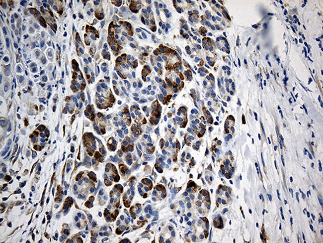 GIPC1 Antibody in Immunohistochemistry (Paraffin) (IHC (P))