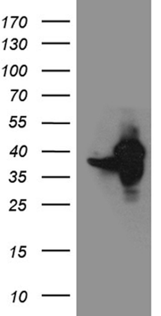GIPC1 Antibody in Western Blot (WB)