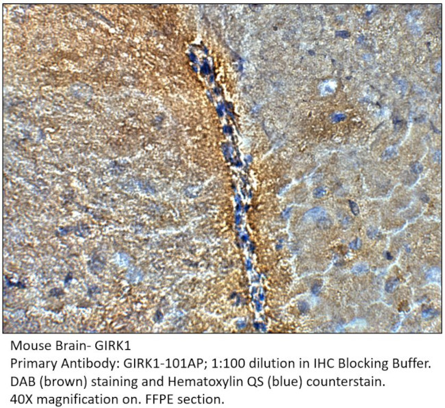 GIRK1 Antibody in Immunohistochemistry (IHC)