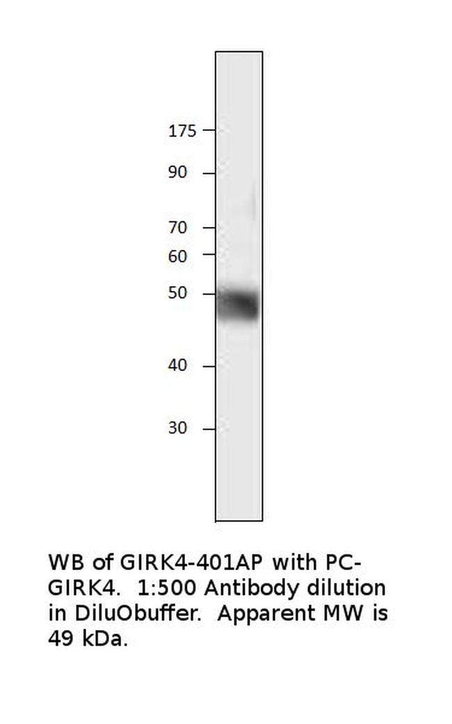 KCNJ5 Antibody in Western Blot (WB)