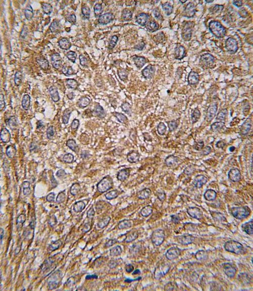 GIT1 Antibody in Immunohistochemistry (IHC)