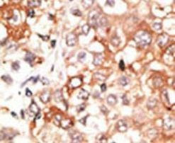 Connexin 45 Antibody in Immunohistochemistry (IHC)