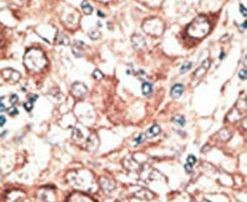Connexin 26 Antibody in Immunohistochemistry (IHC)