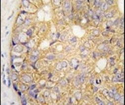 Connexin 30 Antibody in Immunohistochemistry (IHC)