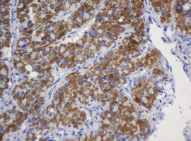 GLB1 Antibody in Immunohistochemistry (Paraffin) (IHC (P))