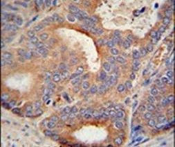 GLB1L2 Antibody in Immunohistochemistry (IHC)