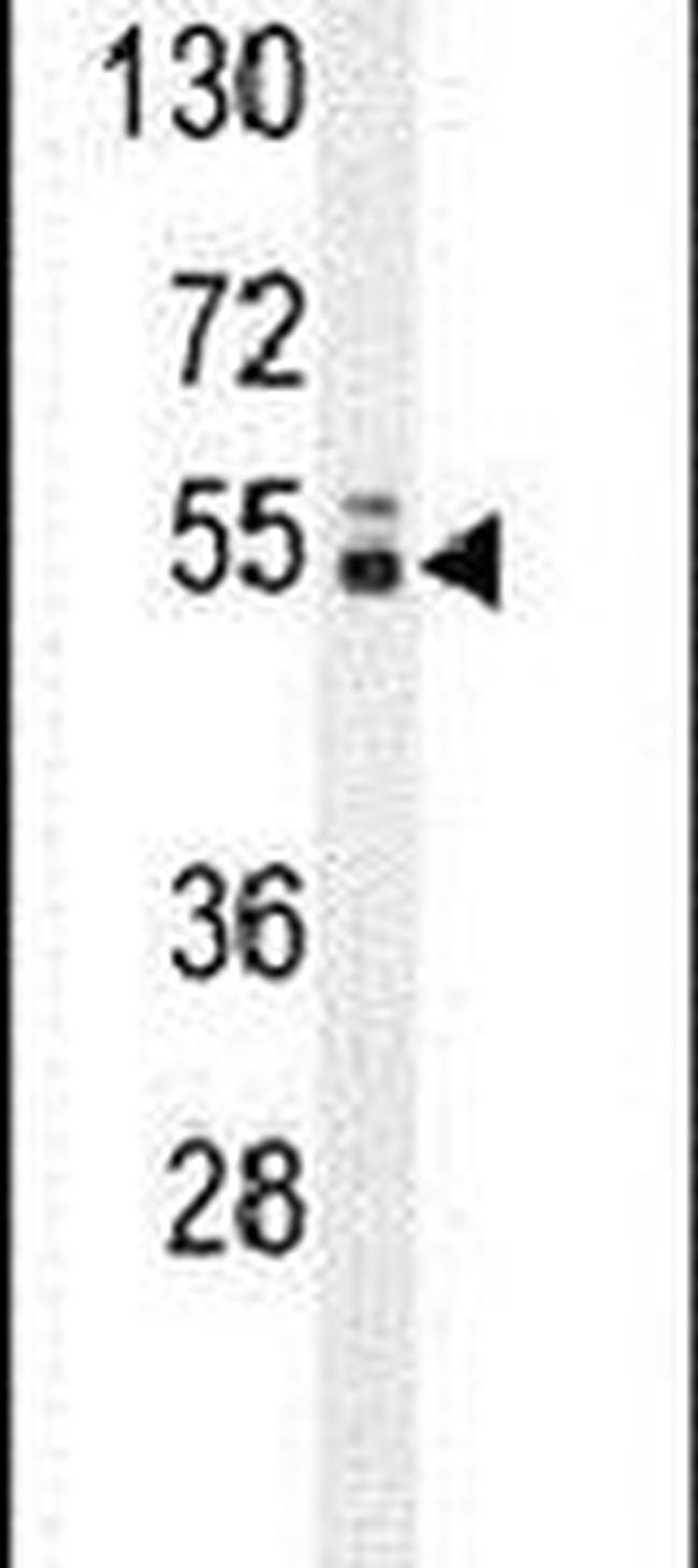 GLCCI1 Antibody in Western Blot (WB)
