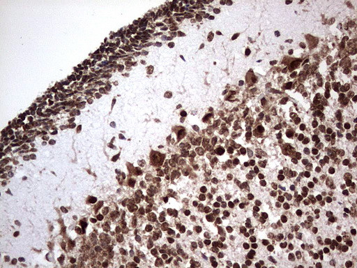 GLI1 Antibody in Immunohistochemistry (Paraffin) (IHC (P))