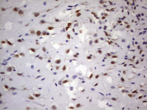 GLI1 Antibody in Immunohistochemistry (Paraffin) (IHC (P))