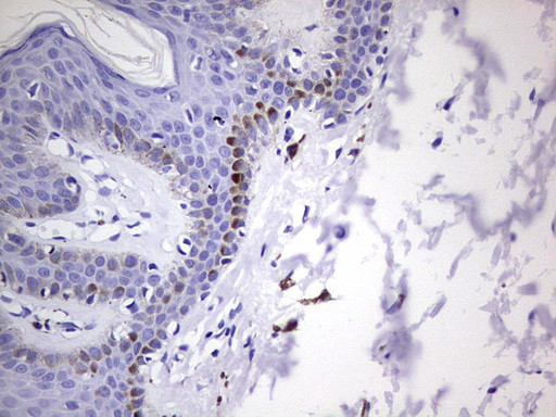 GLI1 Antibody in Immunohistochemistry (Paraffin) (IHC (P))
