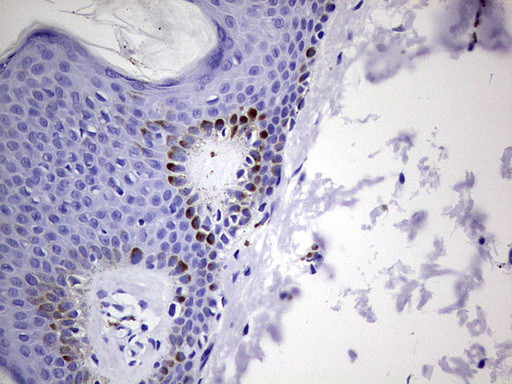 GLI1 Antibody in Immunohistochemistry (Paraffin) (IHC (P))