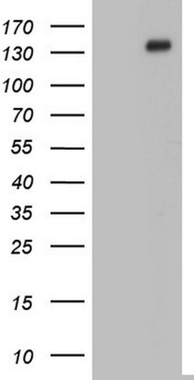 GLI1 Antibody in Western Blot (WB)
