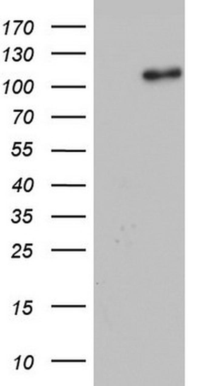 GLI1 Antibody in Western Blot (WB)