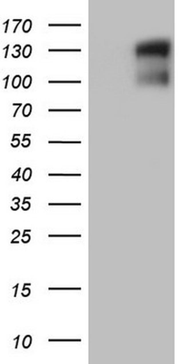 GLI1 Antibody in Western Blot (WB)