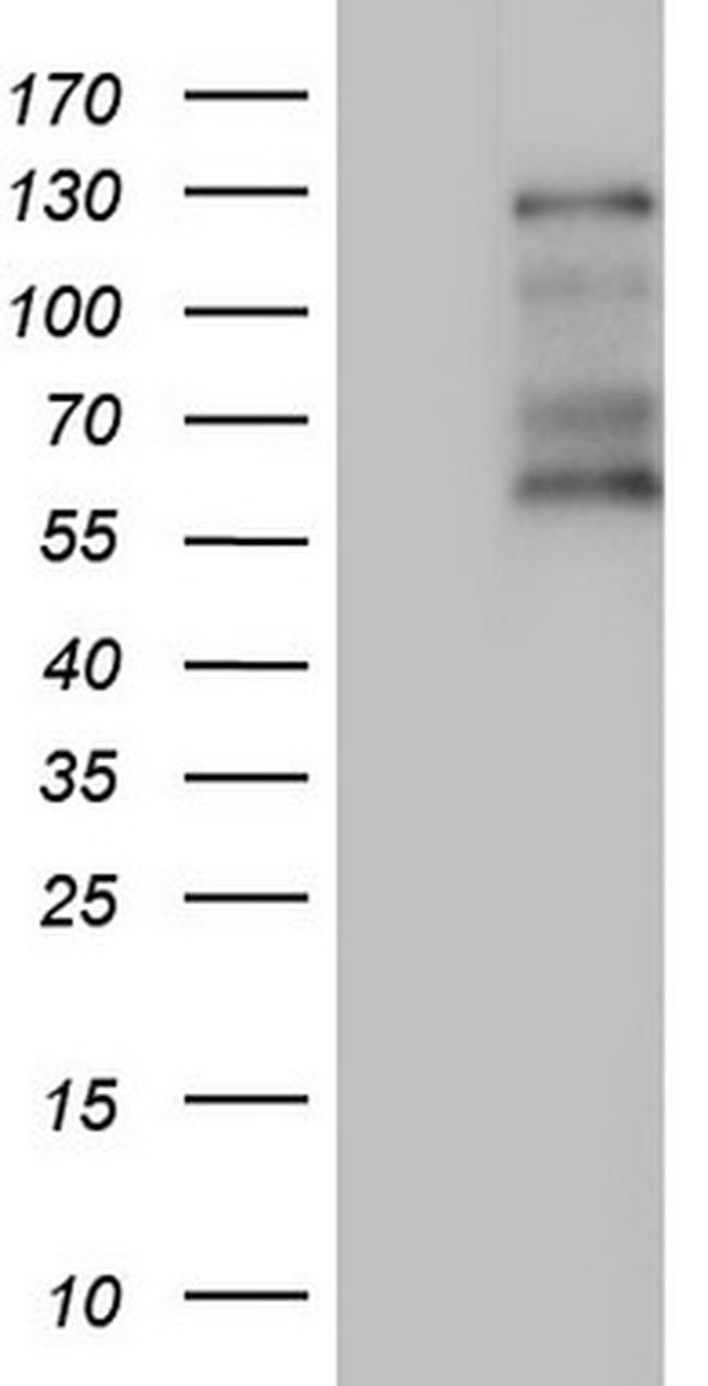 GLI1 Antibody in Western Blot (WB)