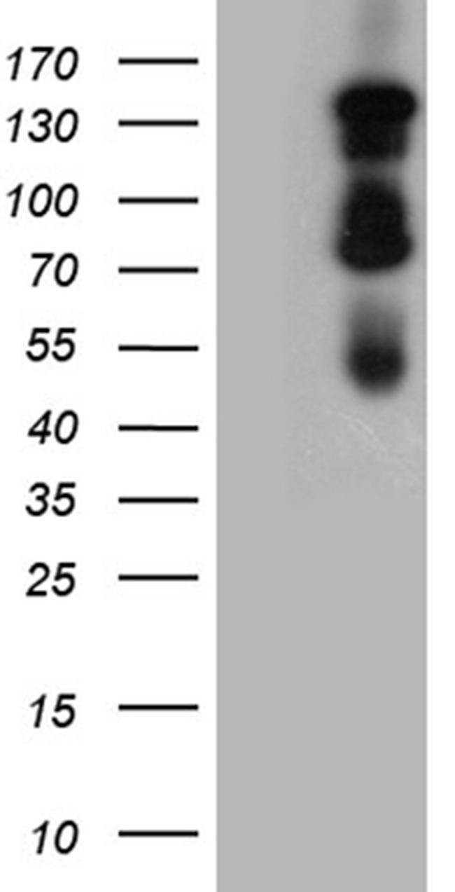 GLI1 Antibody in Western Blot (WB)