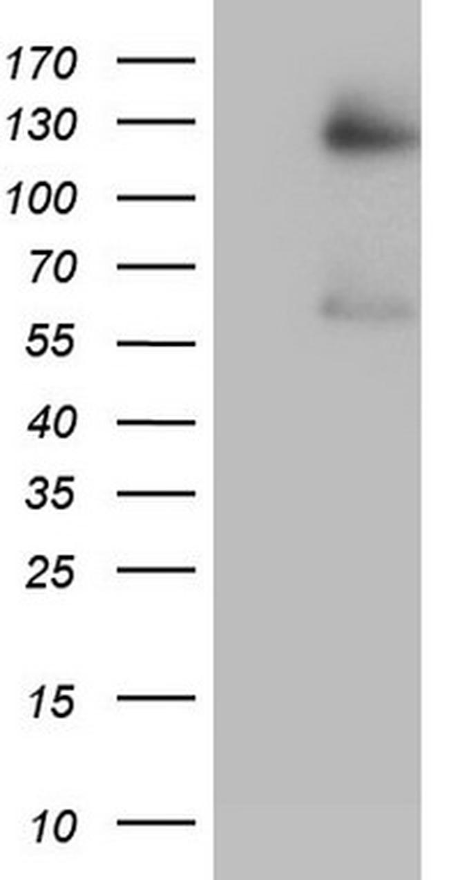 GLI1 Antibody in Western Blot (WB)