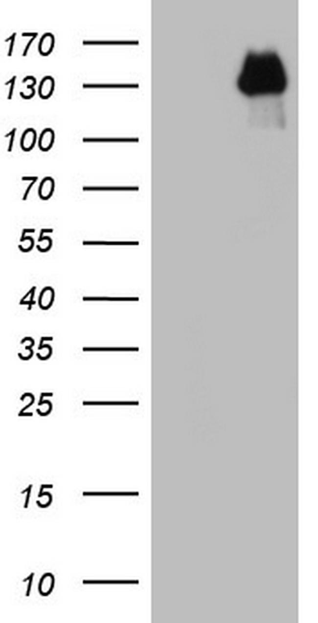 GLI1 Antibody in Western Blot (WB)