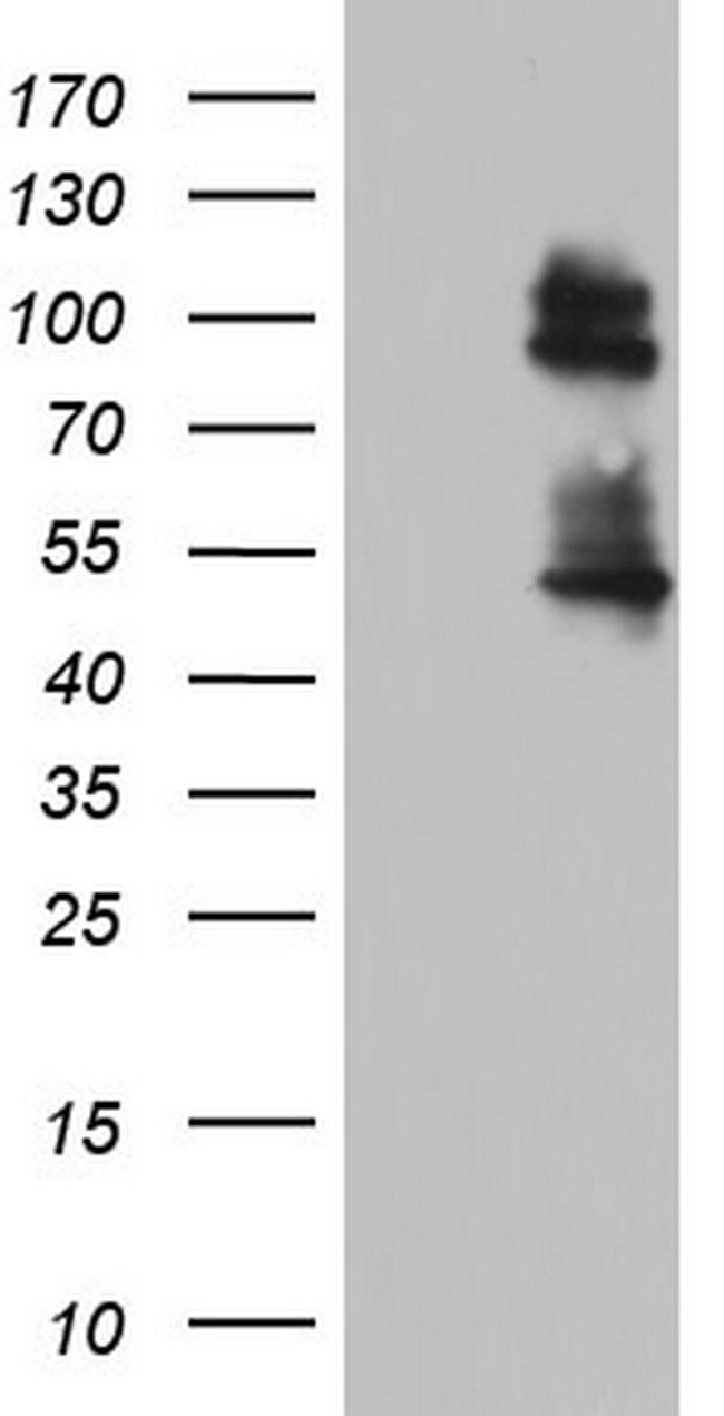 GLI1 Antibody in Western Blot (WB)