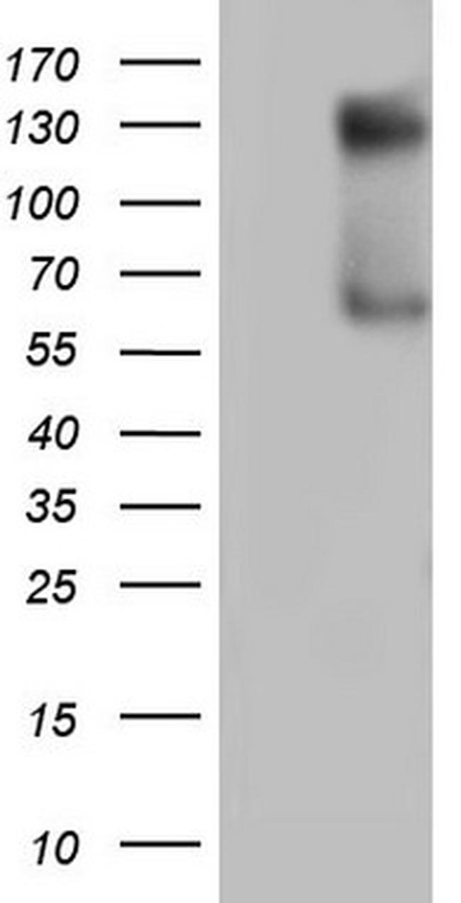 GLI1 Antibody in Western Blot (WB)