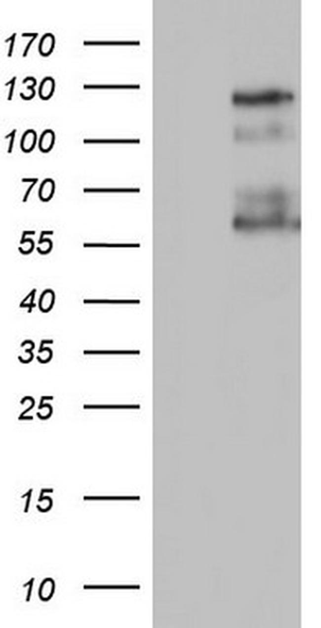 GLI1 Antibody in Western Blot (WB)