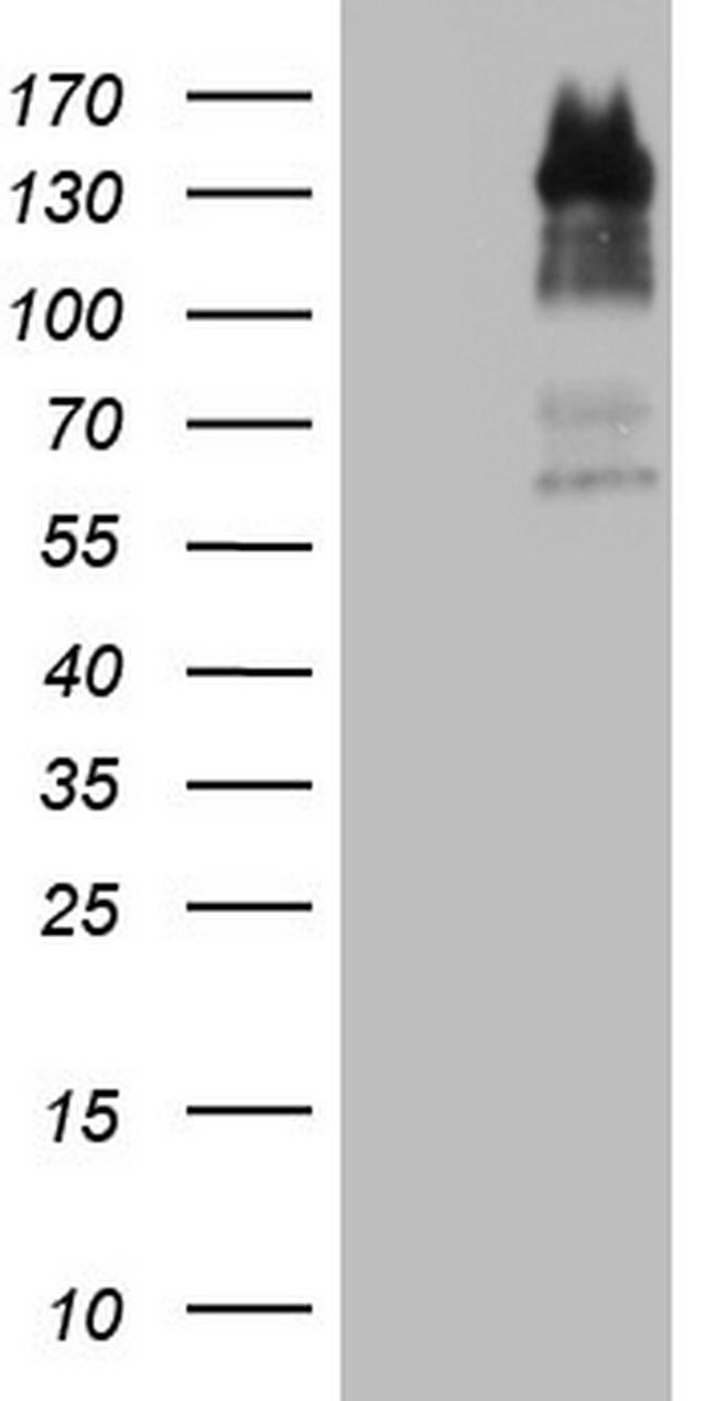 GLI1 Antibody in Western Blot (WB)