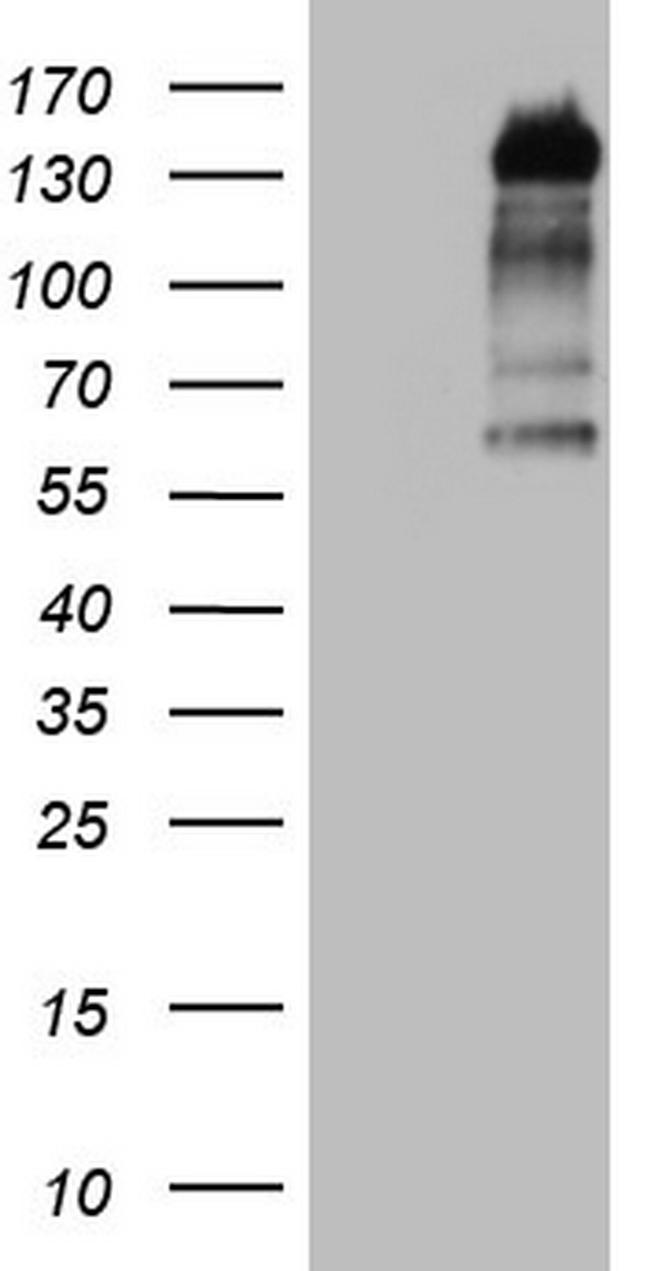 GLI1 Antibody in Western Blot (WB)