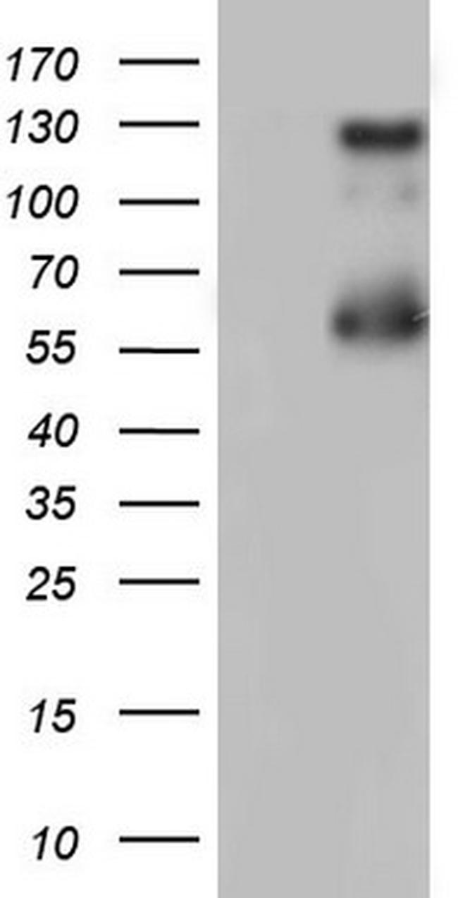 GLI1 Antibody in Western Blot (WB)
